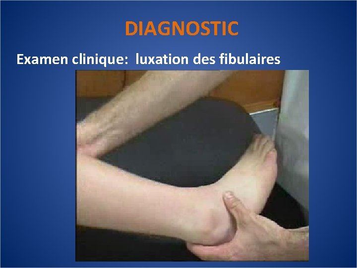 DIAGNOSTIC Examen clinique: luxation des fibulaires 