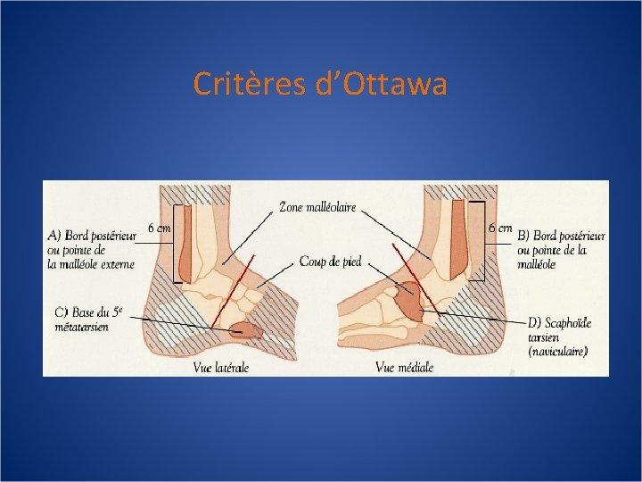 Critères d’Ottawa 