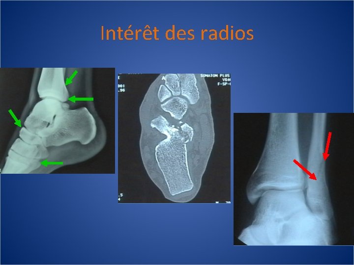 Intérêt des radios 