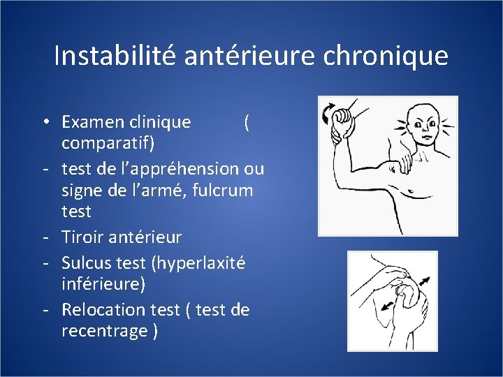 Instabilité antérieure chronique • Examen clinique ( comparatif) - test de l’appréhension ou signe