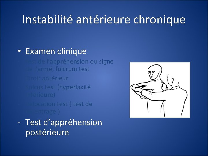 Instabilité antérieure chronique • Examen clinique - test de l’appréhension ou signe de l’armé,