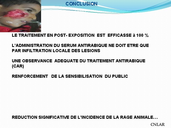 CONCLUSION LE TRAITEMENT EN POST- EXPOSITION EST EFFICASSE à 100 % L’ADMINISTRATION DU SERUM