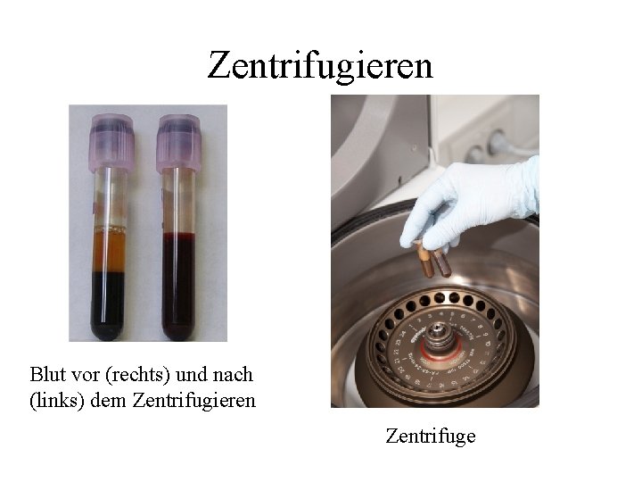 Zentrifugieren Blut vor (rechts) und nach (links) dem Zentrifugieren Zentrifuge 