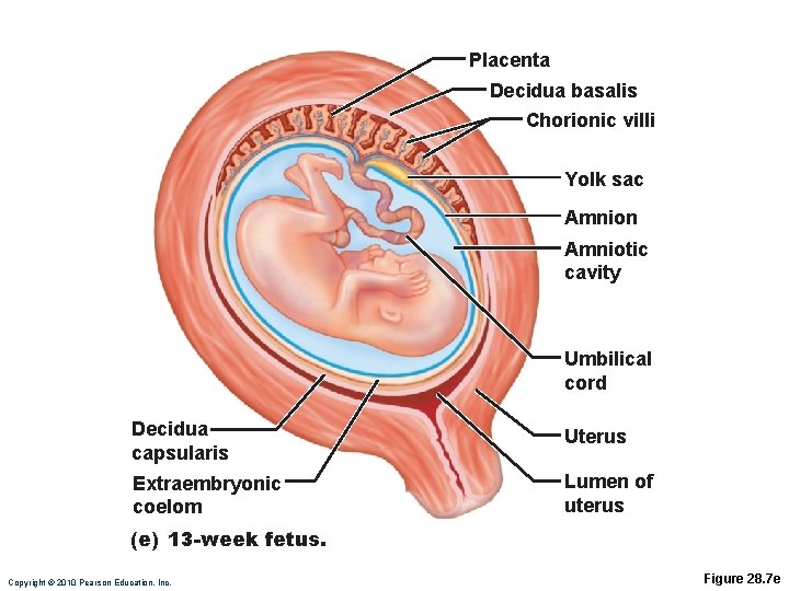 Placenta Decidua basalis Chorionic villi Yolk sac Amnion Amniotic cavity Umbilical cord Decidua capsularis