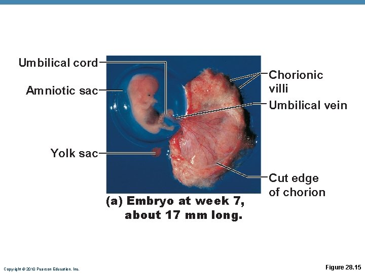 Umbilical cord Chorionic villi Umbilical vein Amniotic sac Yolk sac (a) Embryo at week