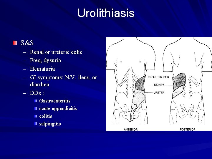 Urolithiasis S&S – – Renal or ureteric colic Freq, dysuria Hematuria GI symptoms: N/V,
