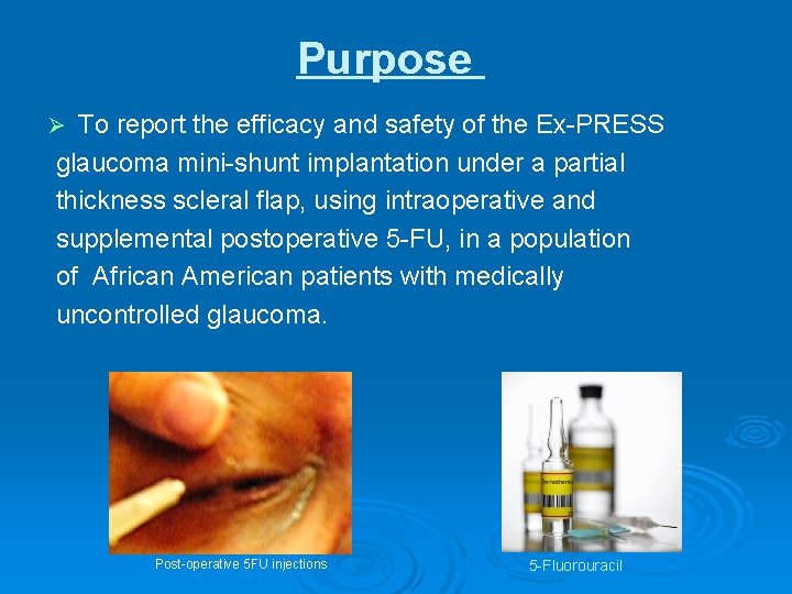 Purpose To report the efficacy and safety of the Ex-PRESS glaucoma mini-shunt implantation under