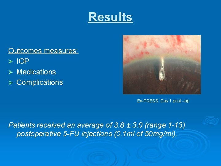 Results Outcomes measures: Ø IOP Ø Medications Ø Complications Ex-PRESS: Day 1 post –op