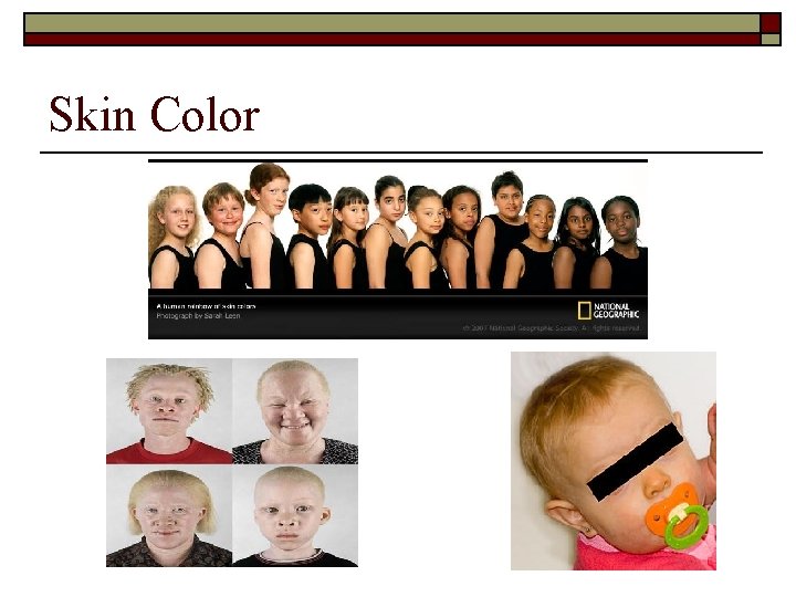 Skin Color 