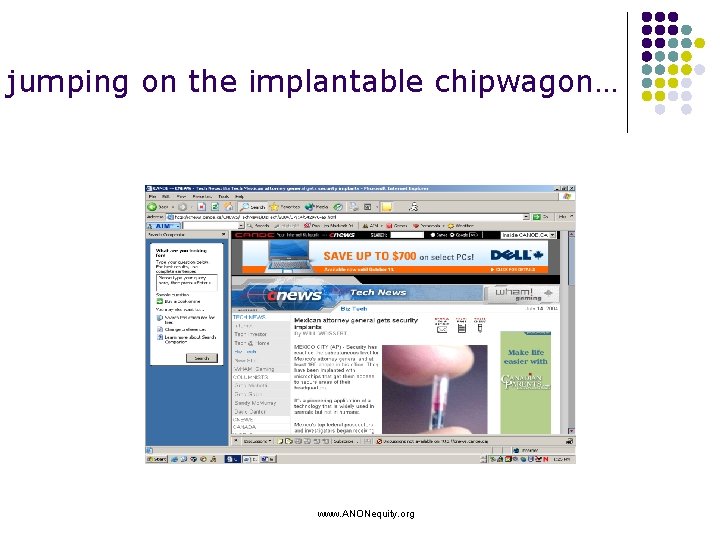 jumping on the implantable chipwagon… www. ANONequity. org 