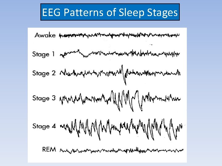 EEG Patterns of Sleep Stages 