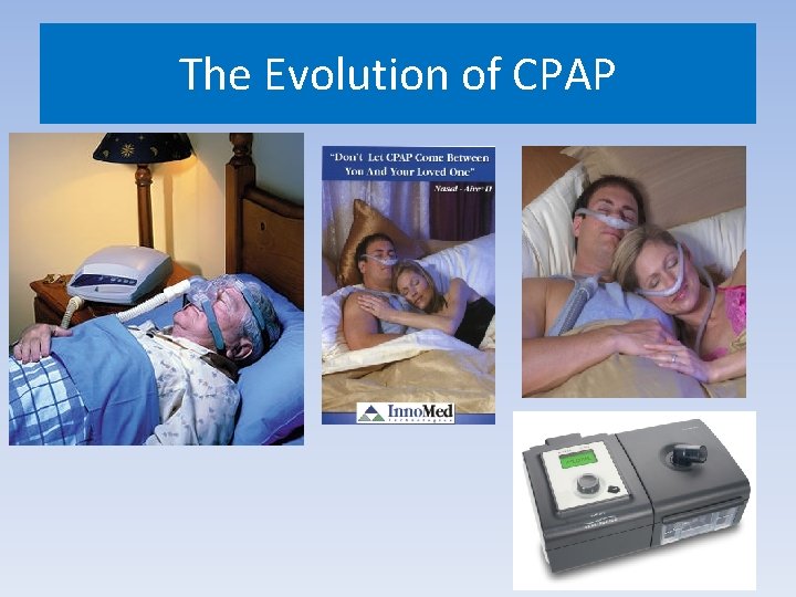The Evolution of CPAP 