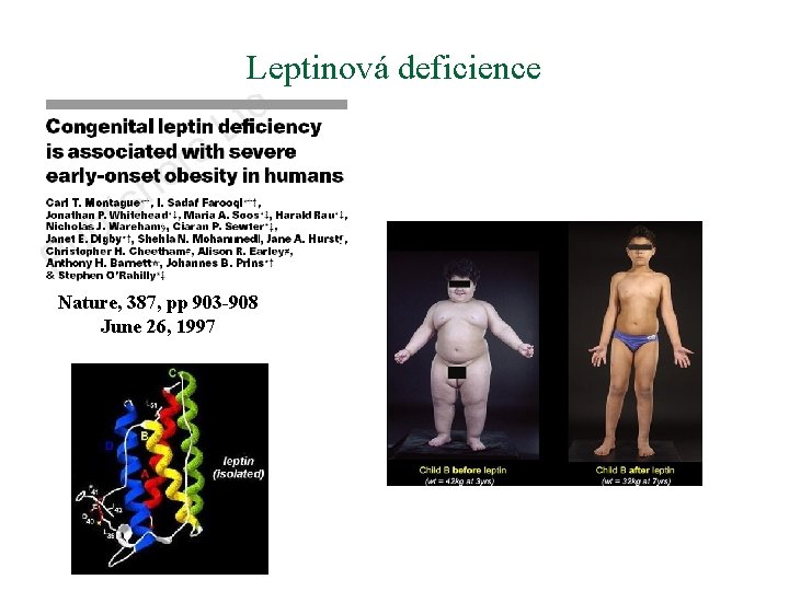 Leptinová deficience Nature, 387, pp 903 -908 June 26, 1997 