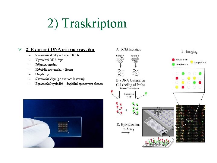 2) Traskriptom Ú 2. Expresní DNA microarray, čip – – – – Stanovení stovky