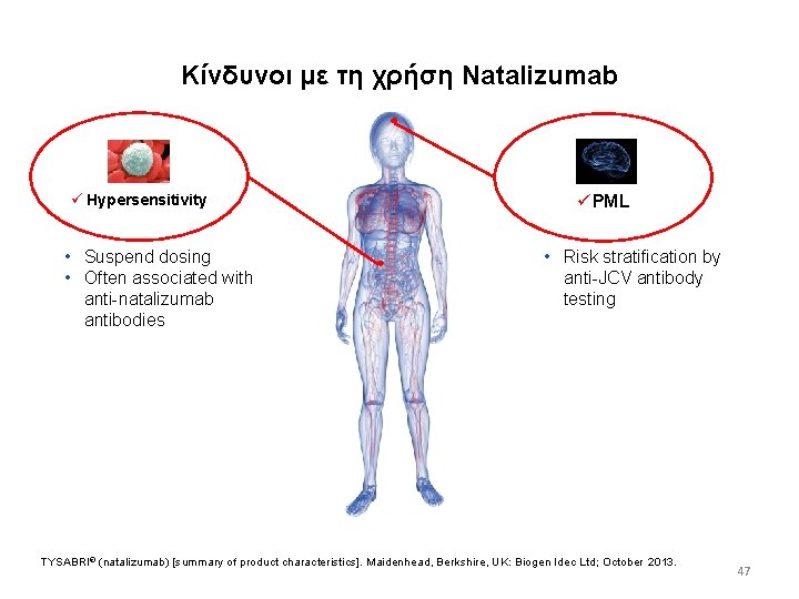 Kίνδυνοι με τη χρήση Natalizumab ü Hypersensitivity • Suspend dosing • Often associated with