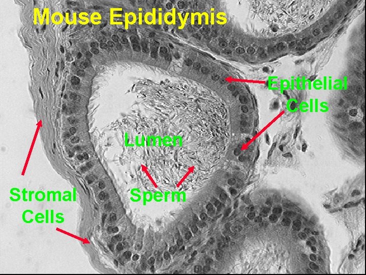 Mouse Epididymis Epithelial Cells Lumen Stromal Cells Sperm 