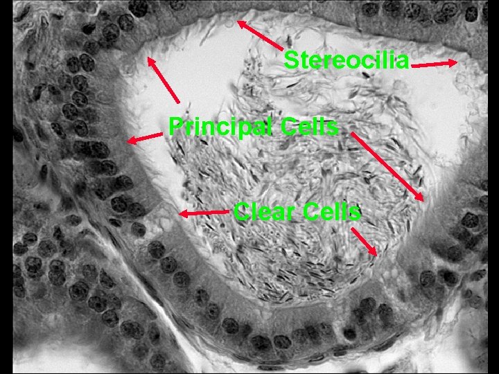 Stereocilia Principal Cells Clear Cells 