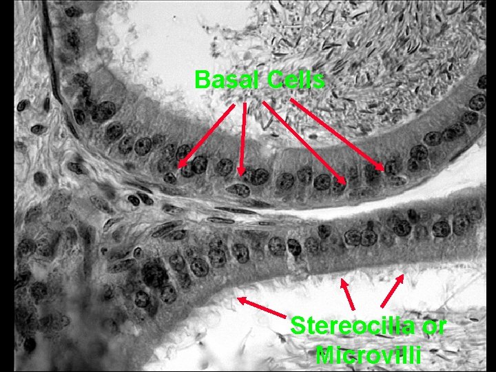 Basal Cells Stereocilia or Microvilli 