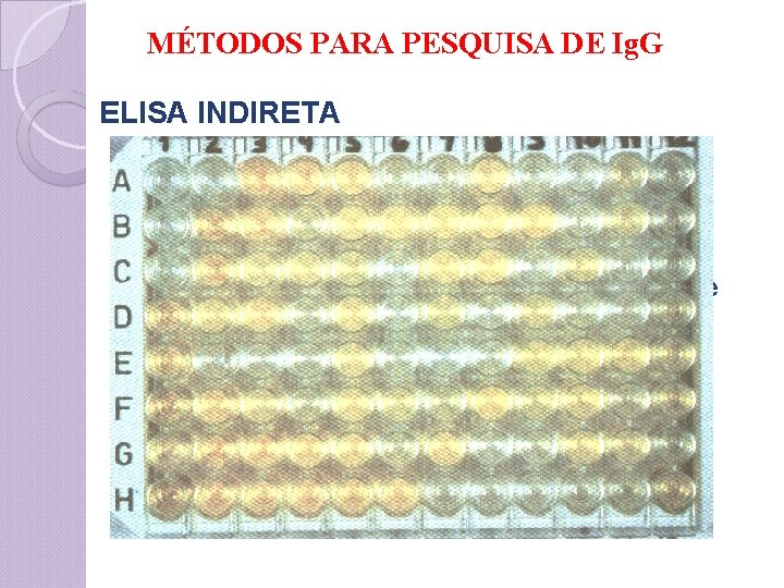 MÉTODOS PARA PESQUISA DE Ig. G ELISA INDIRETA v. Ig. M - Reações falso-negativas,