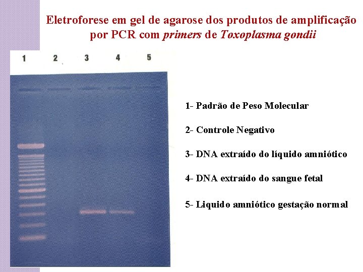 Eletroforese em gel de agarose dos produtos de amplificação por PCR com primers de