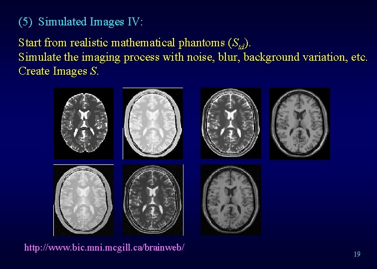 (5) Simulated Images IV: Start from realistic mathematical phantoms (Std). Simulate the imaging process