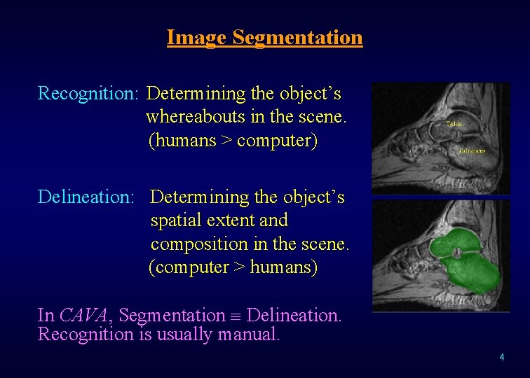 Image Segmentation Recognition: Determining the object’s whereabouts in the scene. (humans > computer) Delineation: