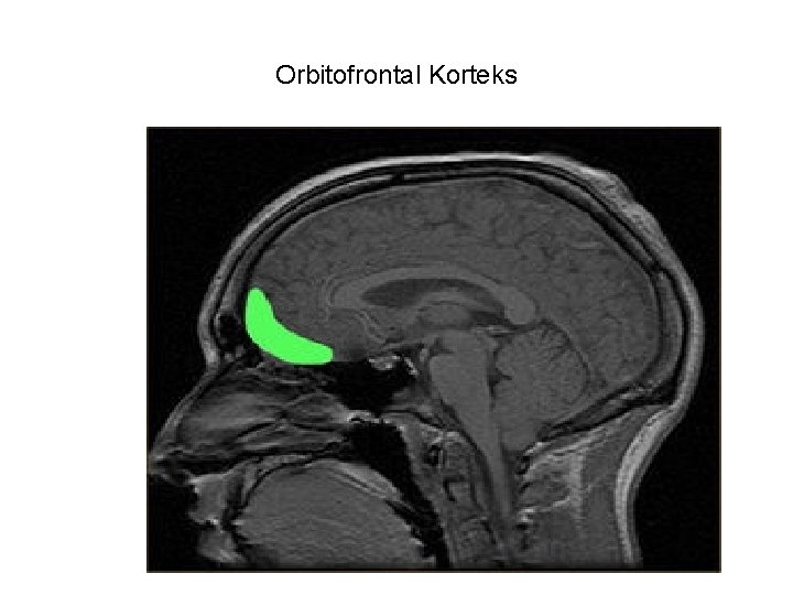 Orbitofrontal Korteks 
