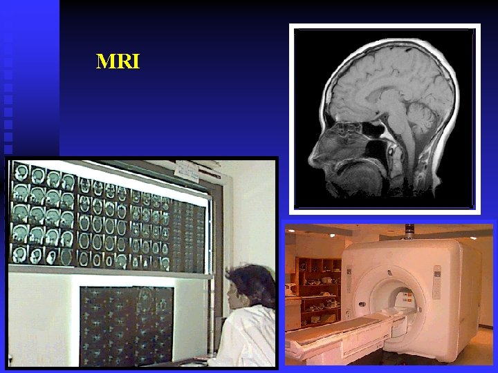 MRI 