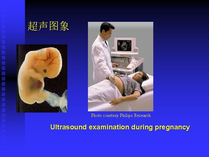 超声图象 Photo courtesy Philips Research Ultrasound examination during pregnancy 