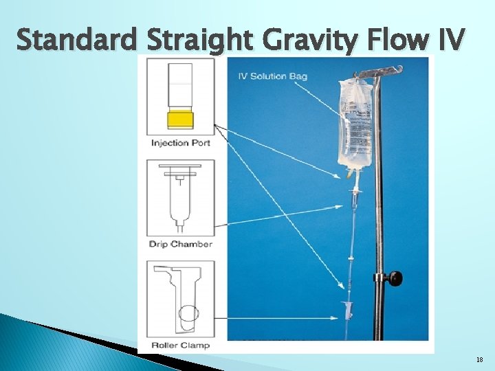 Standard Straight Gravity Flow IV 18 