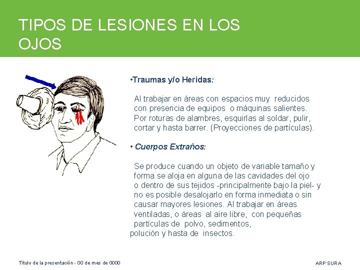 TIPOS DE LESIONES EN LOS OJOS • Traumas y/o Heridas: Al trabajar en áreas