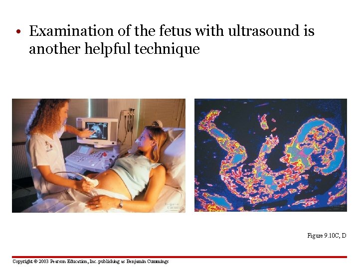  • Examination of the fetus with ultrasound is another helpful technique Figure 9.