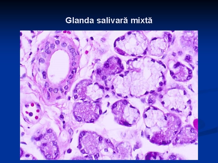Glanda salivară mixtă 
