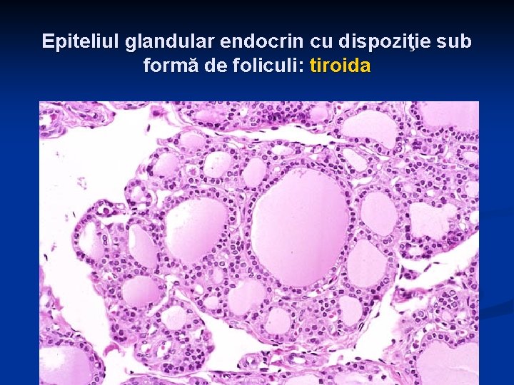 Epiteliul glandular endocrin cu dispoziţie sub formă de foliculi: tiroida 