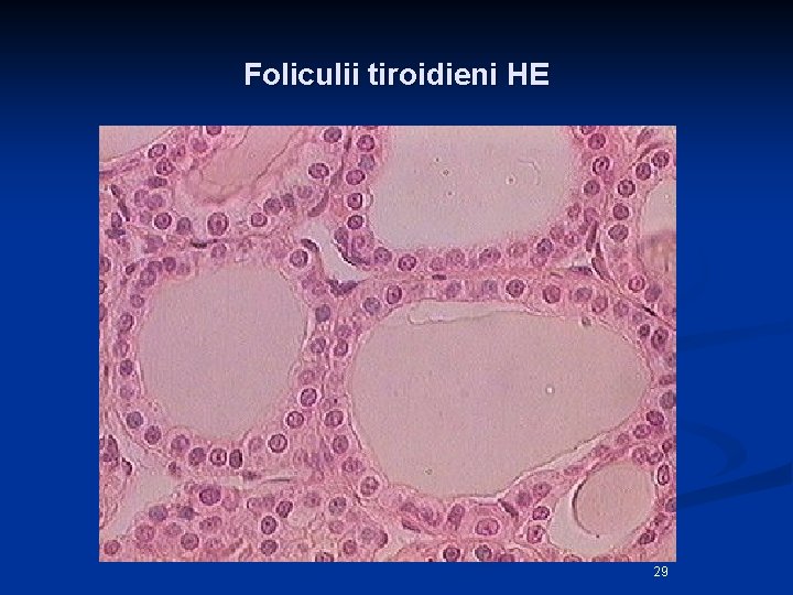 Foliculii tiroidieni HE 29 