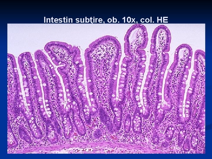 Intestin subţire, ob. 10 x, col. HE 5 