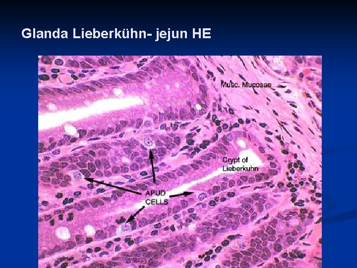 Glanda Lieberkühn- jejun HE 6 