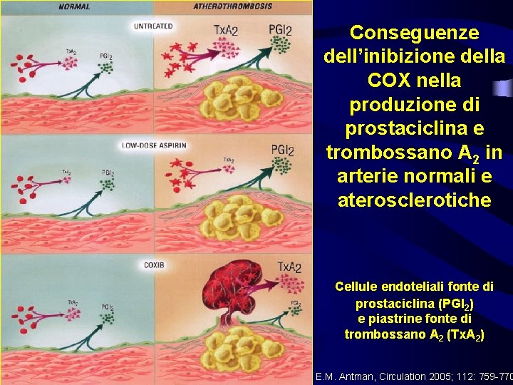 Conseguenze dell’inibizione della COX nella produzione di prostaciclina e trombossano A 2 in arterie