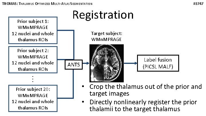 THOMAS: THALAMUS OPTIMIZED MULTI-ATLAS SEGMENTATION Prior subject 1: WMn. MPRAGE 12 nuclei and whole