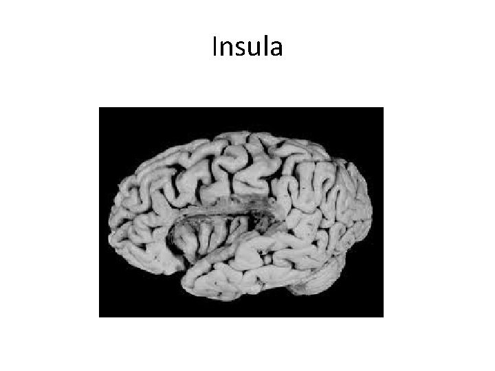 Insula 