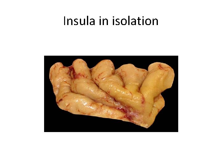 Insula in isolation 