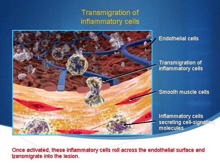 Transmigration of inflammatory cells Endothelial cells Transmigration of inflammatory cells Smooth muscle cells Inflammatory