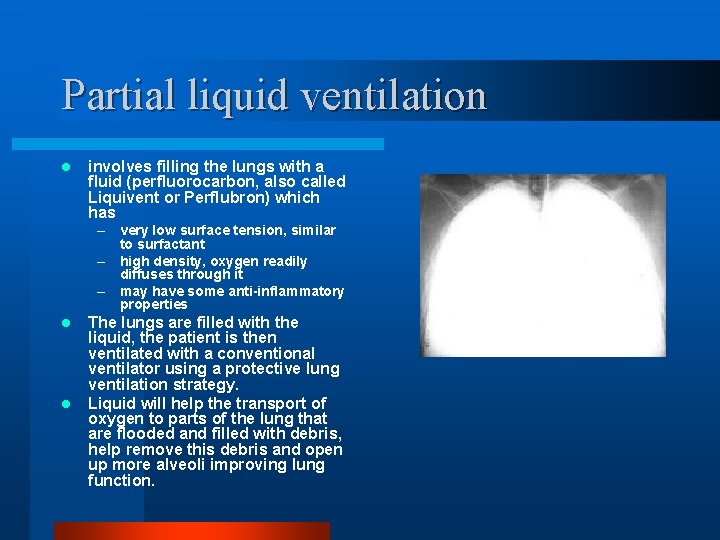 Partial liquid ventilation l involves filling the lungs with a fluid (perfluorocarbon, also called