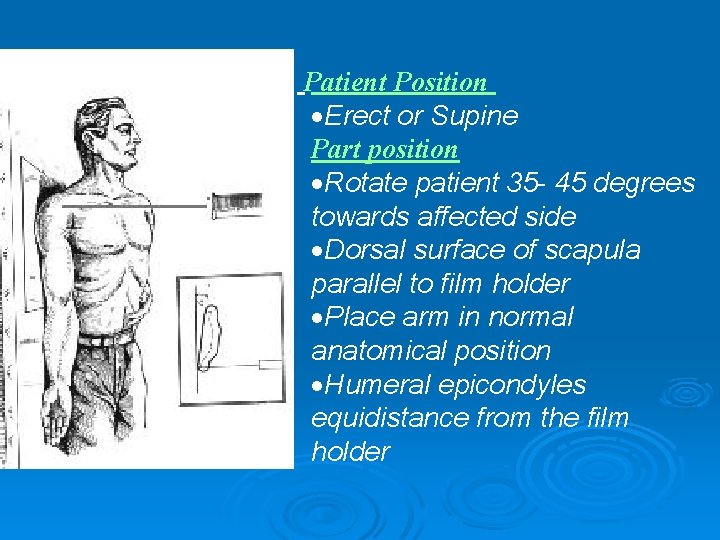 Patient Position Erect or Supine Part position Rotate patient 35 - 45 degrees towards