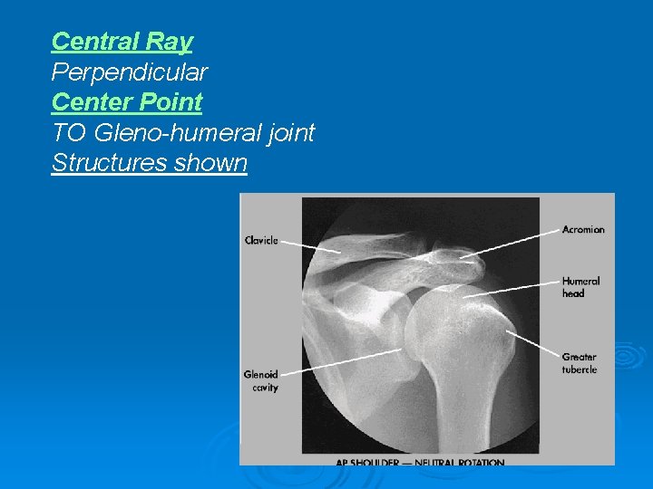 Central Ray Perpendicular Center Point TO Gleno-humeral joint Structures shown 