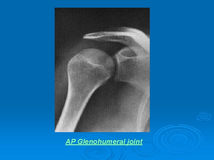 AP Glenohumeral joint 