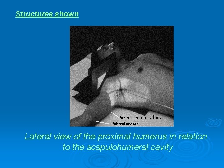 Structures shown Lateral view of the proximal humerus in relation to the scapulohumeral cavity