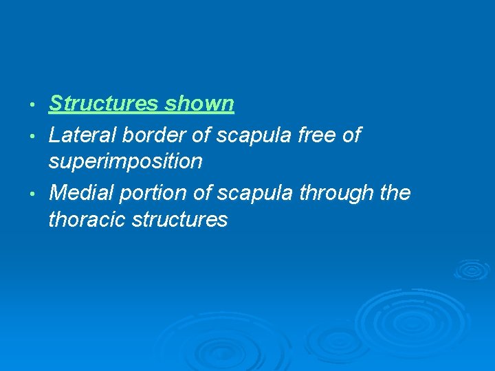 Structures shown • Lateral border of scapula free of superimposition • Medial portion of