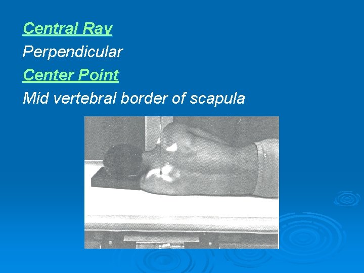 Central Ray Perpendicular Center Point Mid vertebral border of scapula 