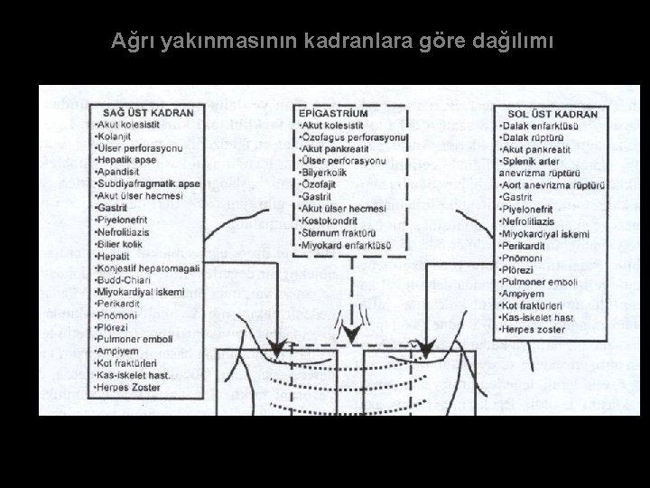 Ağrı yakınmasının kadranlara göre dağılımı 